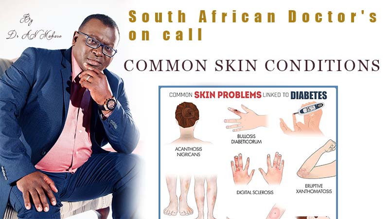 Common skin conditions